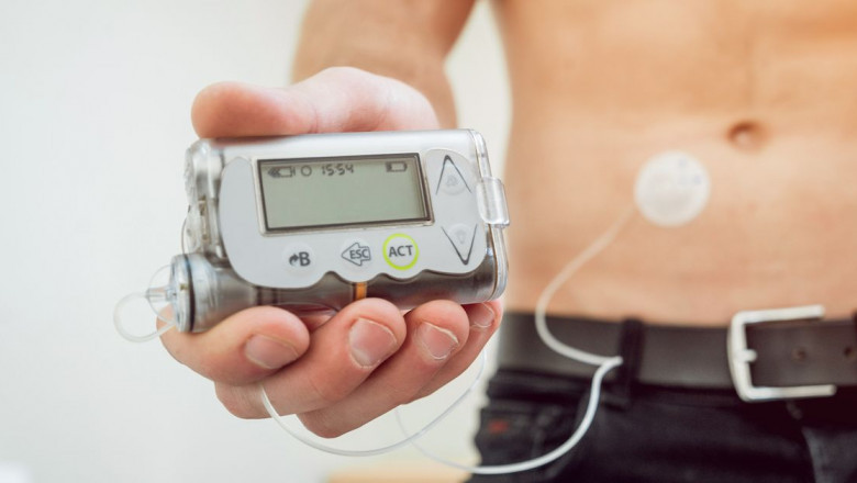 Continuous Drives Growth of the Insulin Delivery Pump Market 2022-2027