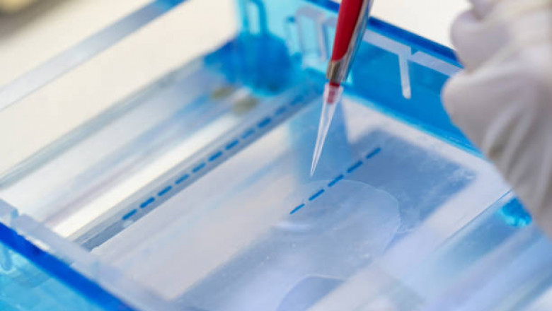 Protein Sequencing Market Scenario, Global Analysis By International Prestigious Players, Industry Demand and Trends by Forecast 2027
