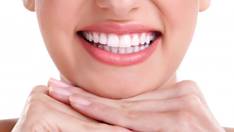 What Are The Advantage And Disadvantage Of Dental Veneers?