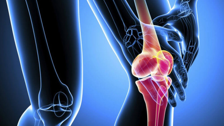 Osteoarthritis Market Latest Innovations, Trends and Forecast
