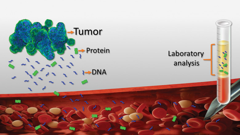 The Liquid Biopsy Market: Global Industry Trends, Share, Size, Growth, Opportunity And Forecast 2019-2027