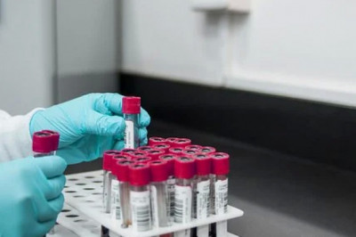 CA 125 Test Market Size, Share, Trends, Application Analysis and Growth Forecast 2027