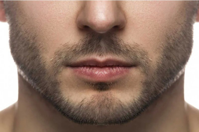 How Fillers Are Used for Male Jawline Contouring