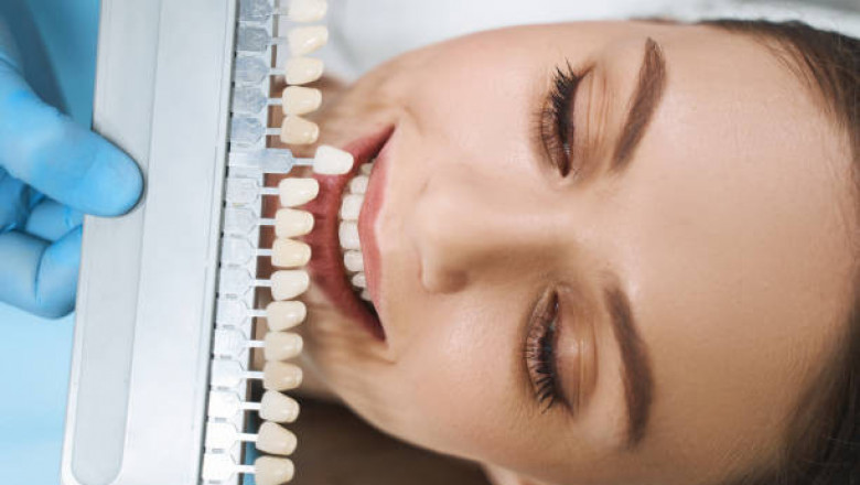 Cosmetic Dentistry Market to Experience Significant Growth by 2037