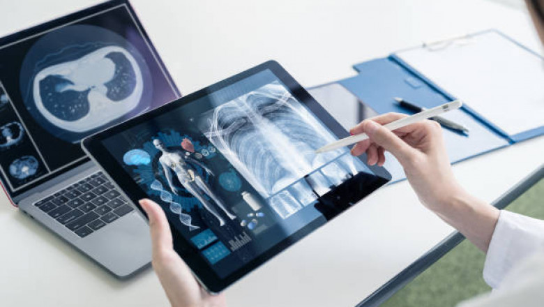 Digital Pathology Market To Witness Steady Growth opportunities During The Forecast Period till 2027