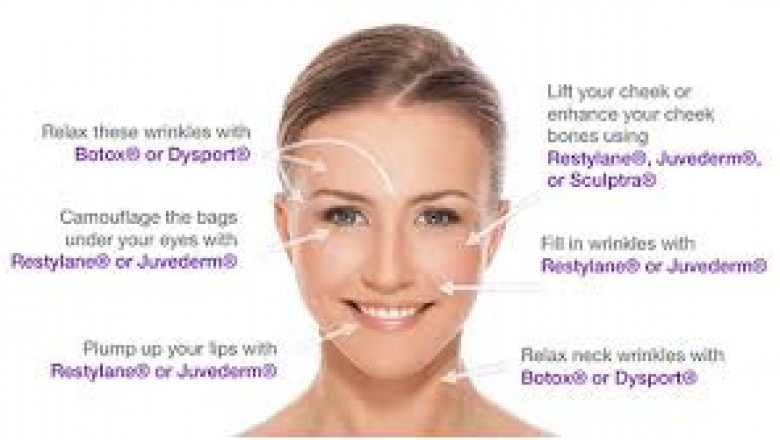 buy dermal fillers online usa1