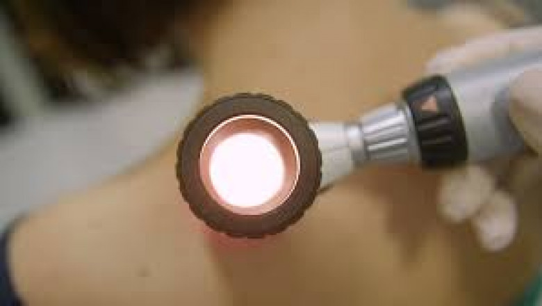 Dermatology Devices Market Revenue, Key Opportunities, Latest Rising Trends, Industry Growth, Future Demand Report 2026