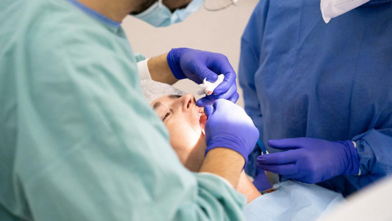 What is a Root Canal Procedure?