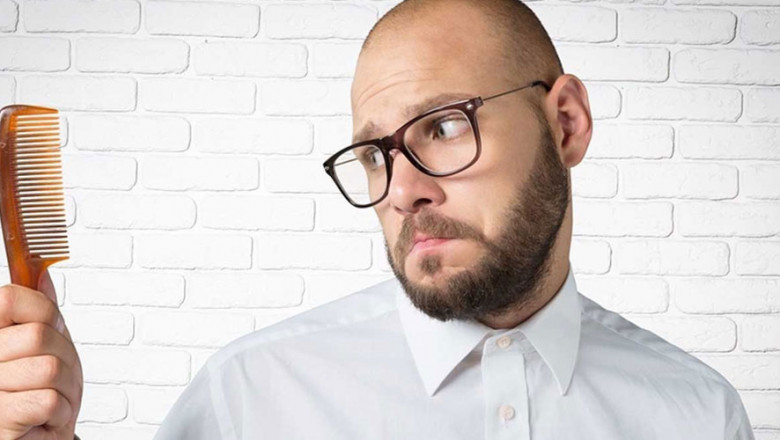 What should you know about male pattern baldness?