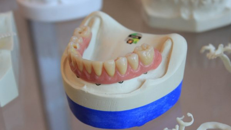 How Can You Prepare Yourself For A Tooth Extraction Procedure?