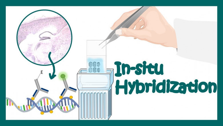 Global Situ Hybridization Market Research Report 2022-2025