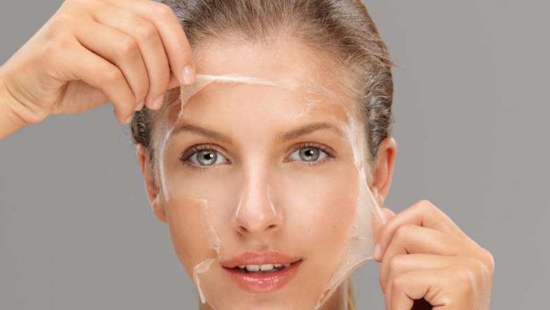 Cosmetic Chemical Peels