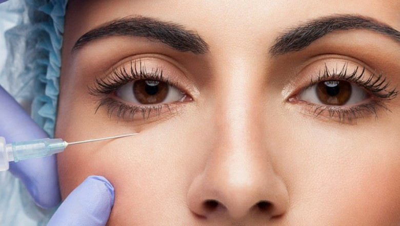 Filler injection under dark eyes