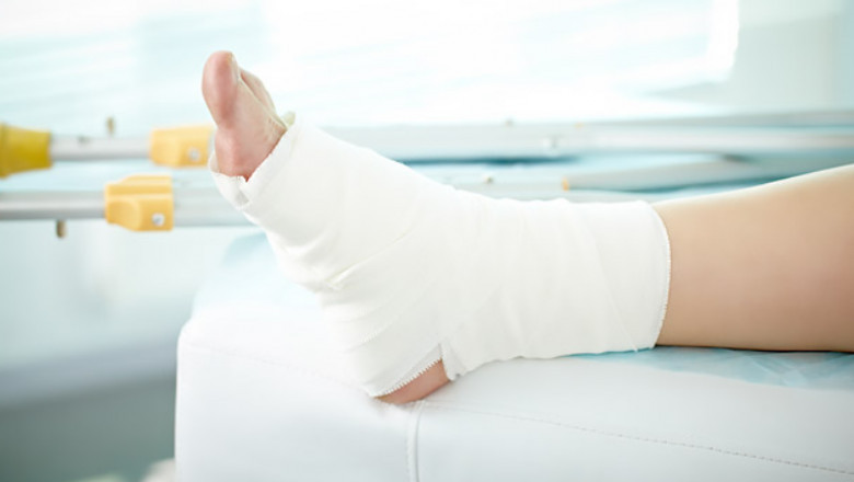 Global Advanced WoundCare Market Study