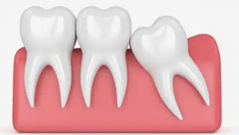 Locating the very best Dental Professionals for a Great Smile