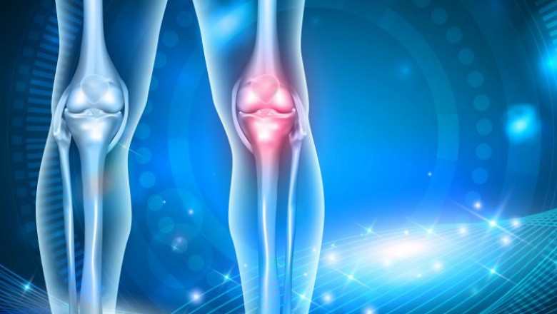 Osteoarthritis Market to Advance at CAGR of 8.7% During 2021-2028; Sanofi, Horizon Therapeutics PLC, Johnson & Johnson