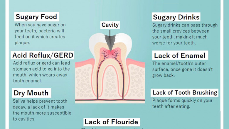 Dentures dentist in Upper West side Manhattan