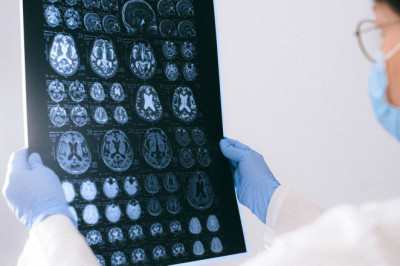 Concussion Specialist For TBI