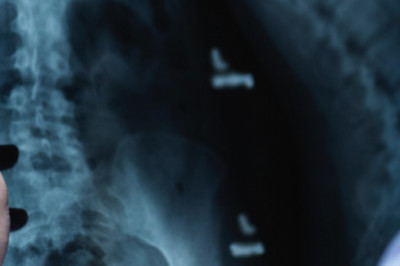 Family medicine| College of Medicine Alfaisal University