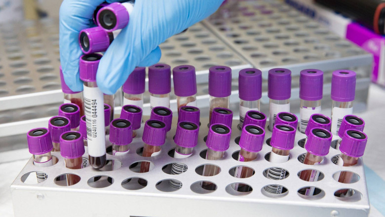 Brief about COVID-19 Sample Collection Kits