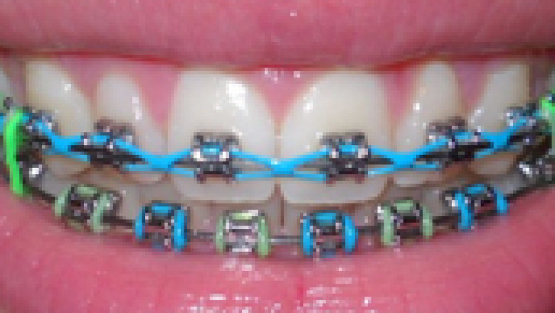 Lawndale Orthodontist