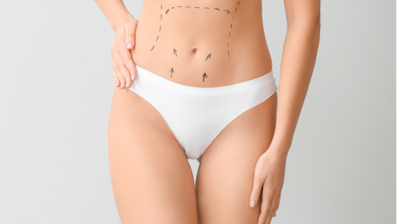 Mommy Makeover dubai - Dr Adnan Tahir