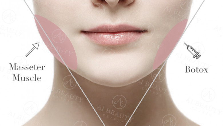 Non-Surgical Jaw Reduction & Jawline slimming