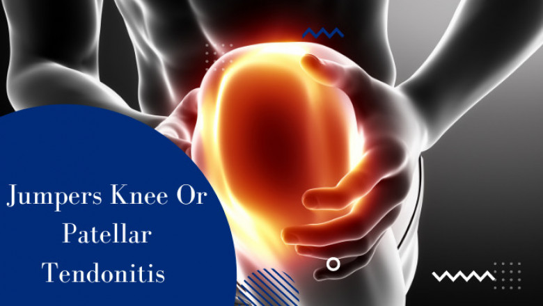Jumpers Knee Or Patellar Tendonitis - Knee Surgeon Dubai