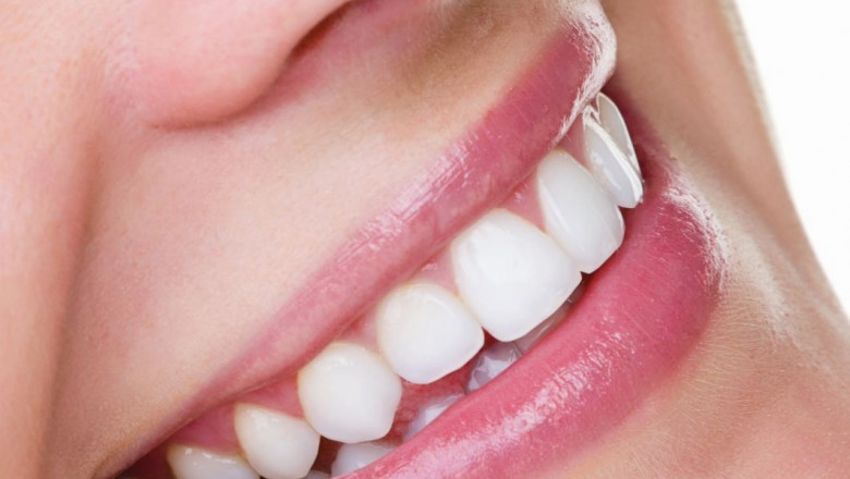 Why Do People Choose To Whiten Teeth, And How Does It Work?