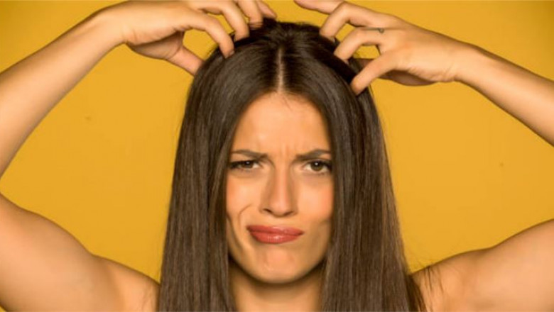 Itchy scalp and hair loss female