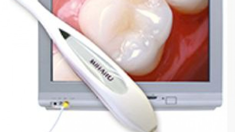 Can Stress Hurt Your Teeth and Jaw?