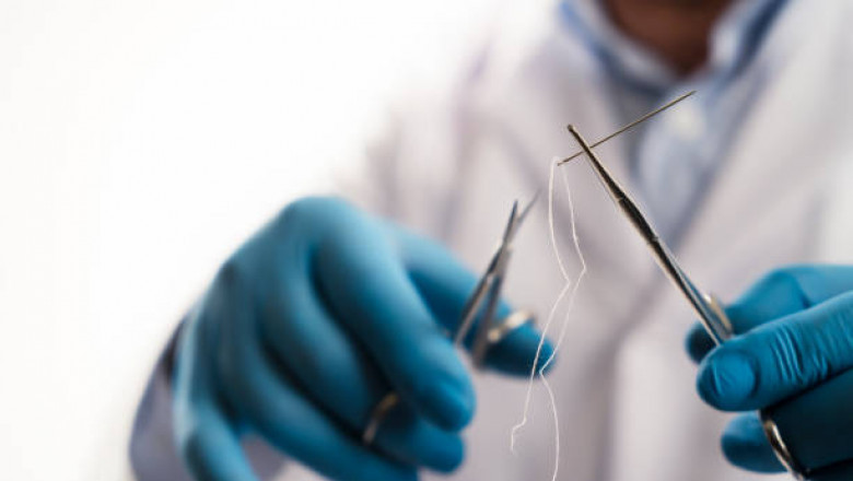 How To Perfect The Art Of Suturing?