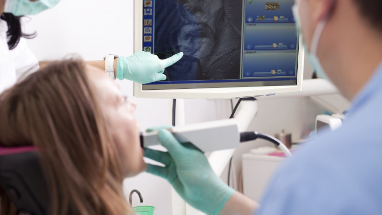 Benefits of Intraoral Cameras