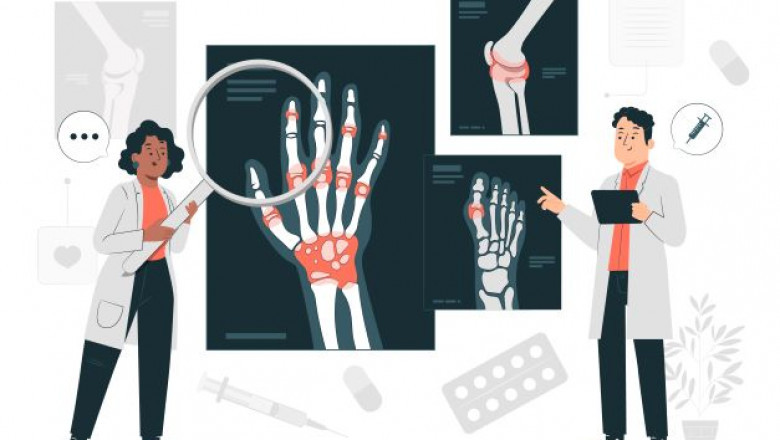 Buy Internal Medicine Email List in USA