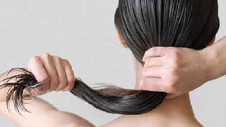 Best Hair Loss Treatment in Hyderabad - FMS Skin and Hair Clinic