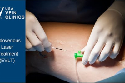 Endovenous Laser Treatment (EVLT)