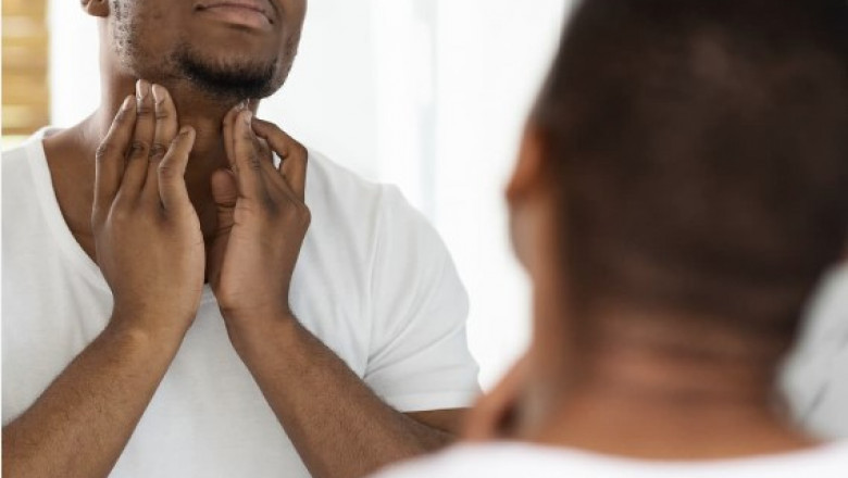 Most common gross skin conditions