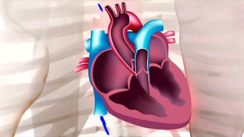 North America to Account for Major Share of Global Eisenmenger Syndrome Treatment Market