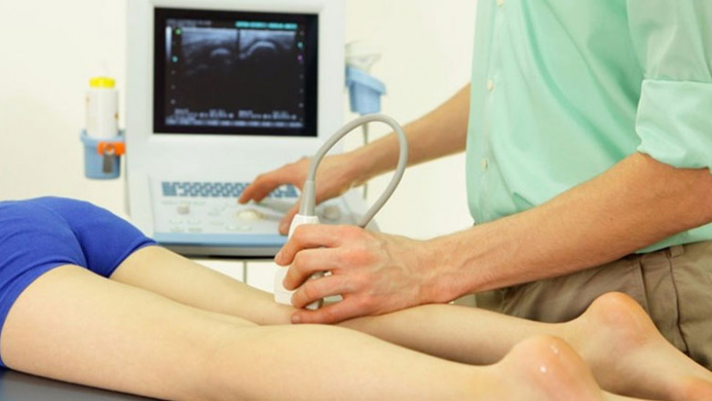 Deep vein thrombosis (DVT) - Diagnosis and treatment