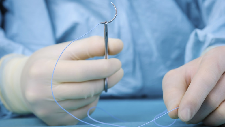 Suture Needles Market Share, Size, Growth & Trends Forecast till 2027