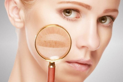 Systemic Lupus Erythematosus Treatment Market Segment Analysis