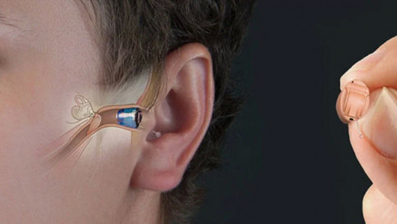 The Audiology Devices Are Intended To Diagnose And Treat Hearing Disorders
