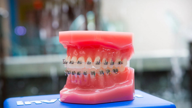 Best Dental Clinic near Thomas VI | Thomas VI Oral Hygiene