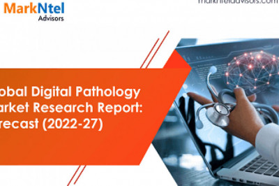 Digital Pathology Market Set for Rapid Growth and Trend by 2022-27