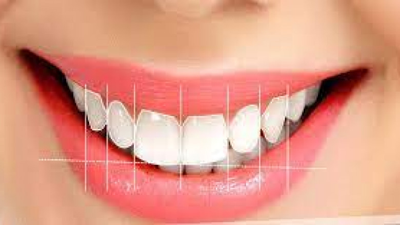 Kids dentist in borivali