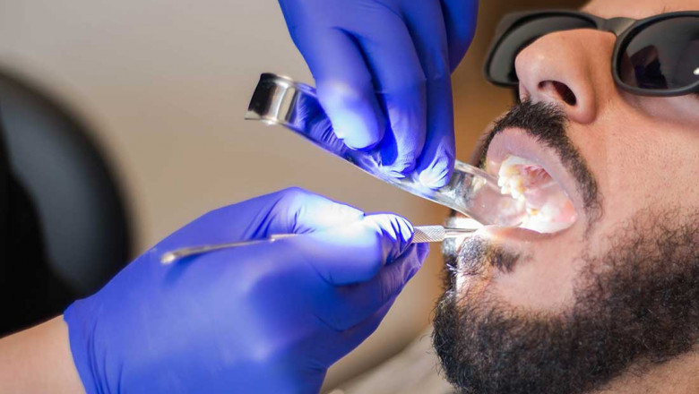 Why Do We Need To Wear Invisalign Aligners, And For How Long?