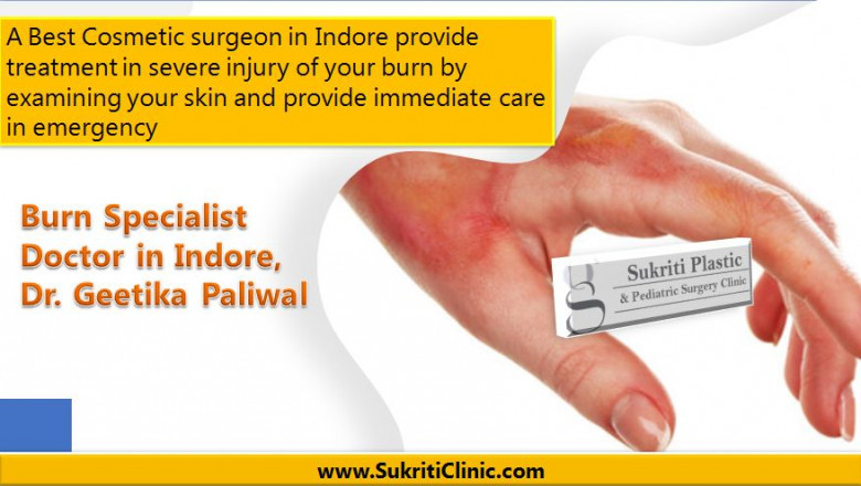 Burn Specialist Doctor in Indore, Dr. Geetika Paliwal