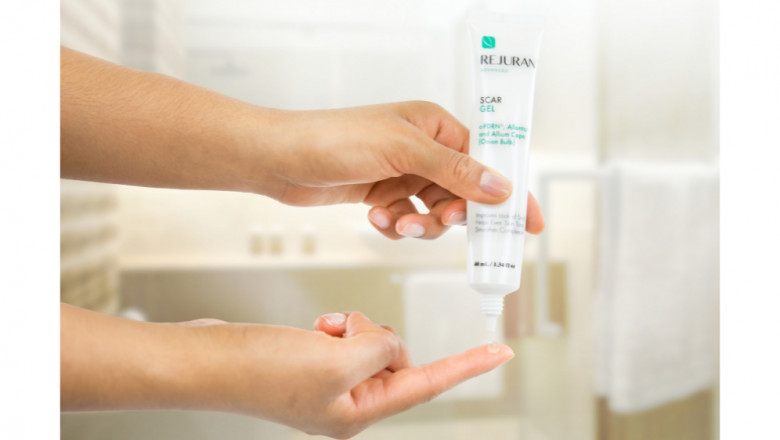 Your Guide to Understanding Scar Creams