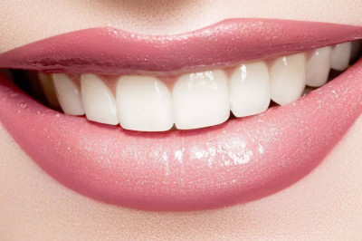 Things You Need To Know To Prep For Teeth Whitening | Tower House Dental Clinic