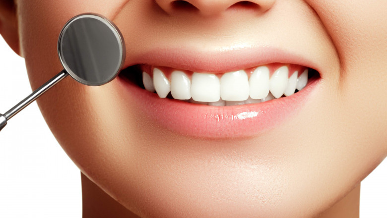 Oral Care In The Mouth Prevents Gum Diseases Such As Cavities, Periodontitis, And Gingivitis